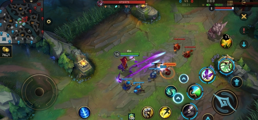 英雄联盟手游凯南选哪个出装